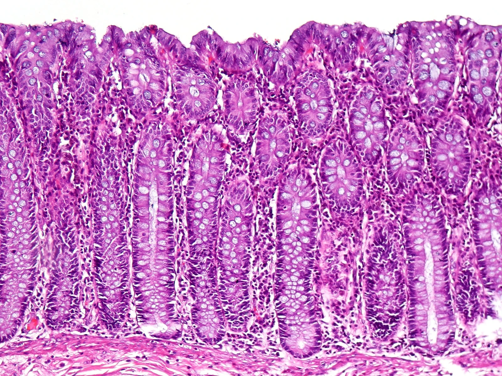 Mucosa de colon sana al microscopio, teñida de violeta y rosa: criptas largas, rectas y paralelas, una junto a otra