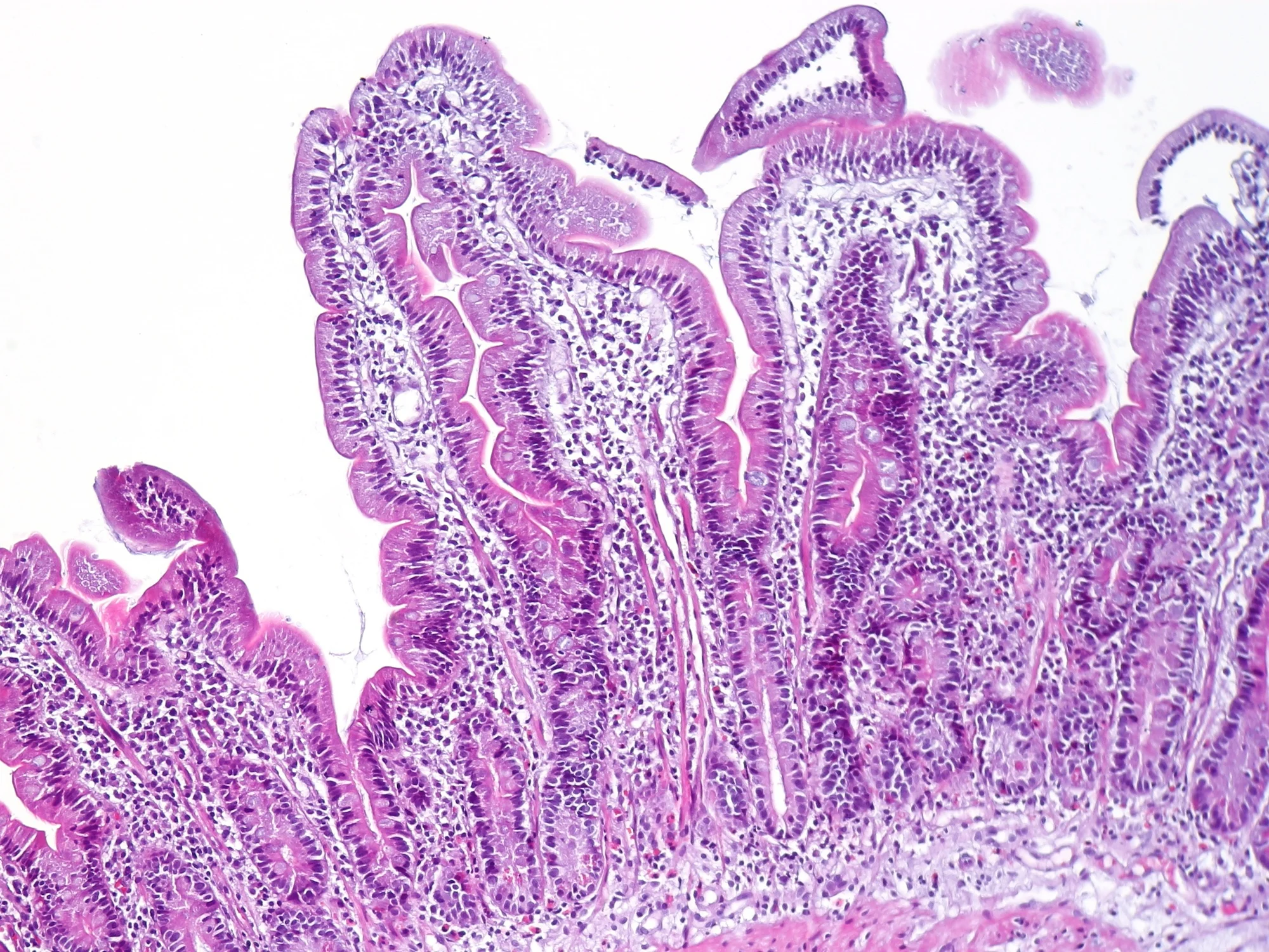 Micrografía de una biopsia duodenal teñida con hematoxilina y eosina: vellosidades y su revestimiento celular; especie no documentada por la fuente