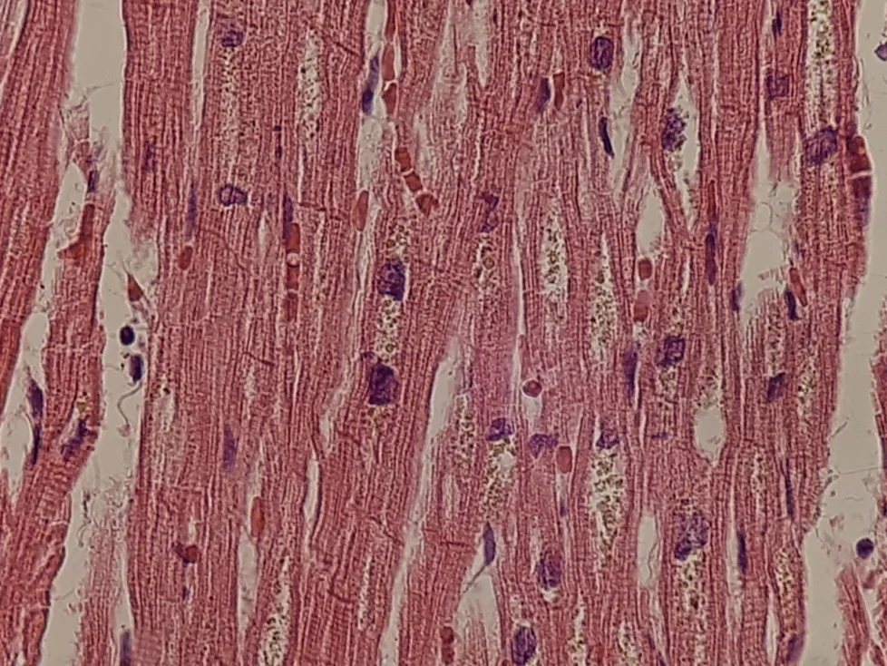 Micrografía de músculo cardiaco con cúmulos de gránulos dorados de lipofuscina junto a los núcleos
