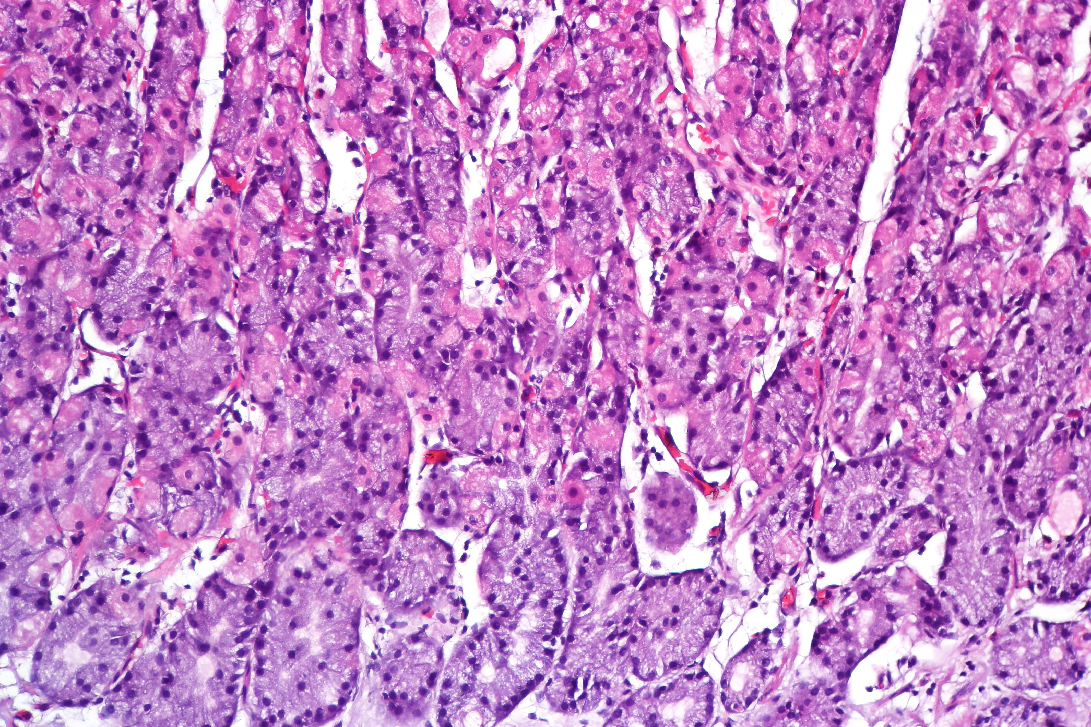 Micrografía H&E de mucosa oxíntica gástrica sin inflamación