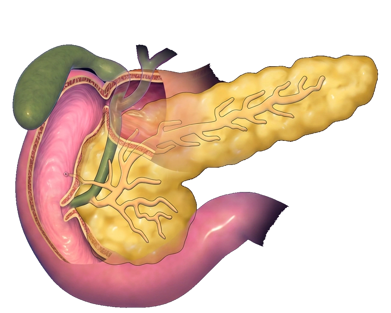 Conducto pancreático ramificado dentro del páncreas y conducto biliar verde que pasa junto a su cabeza; ambos desembocan en el duodeno.