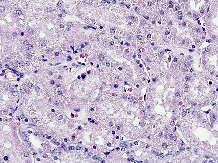 Corteza de riñón humano normal teñida con hematoxilina y eosina: túbulos con paredes gruesas de células y luz pequeña