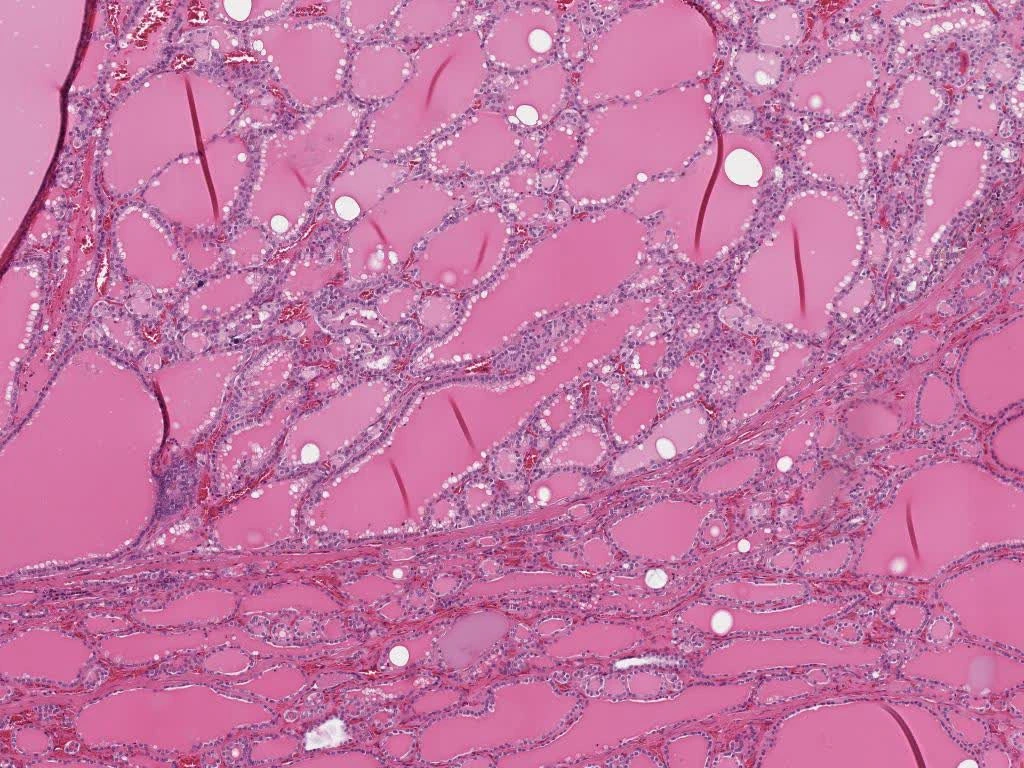 Micrografía de tiroides con folículos redondos llenos de coloide