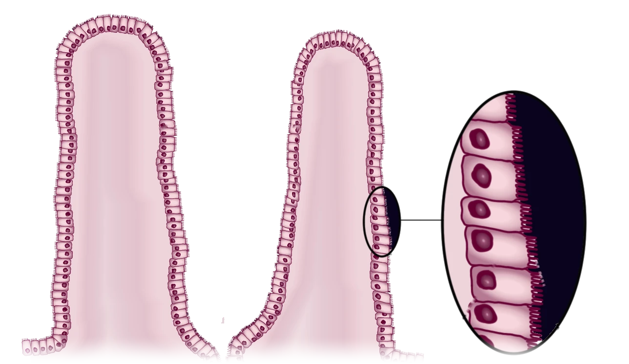 Esquema de dos vellosidades del intestino delgado cubiertas por una capa de enterocitos, con un óvalo de aumento que muestra las células, sus núcleos y las microvellosidades de su superficie