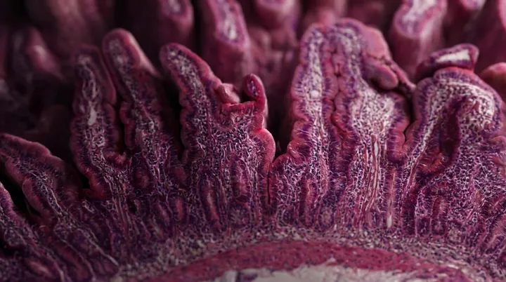 El intestino que puede verse normal