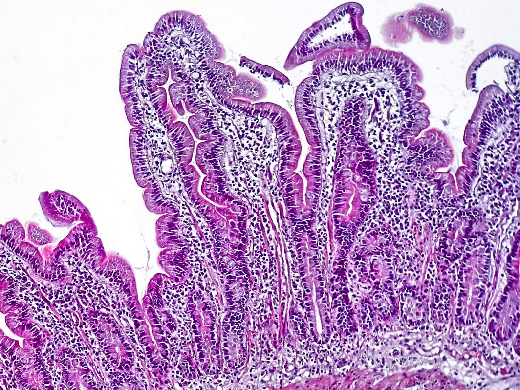 Duodeno sano al microscopio