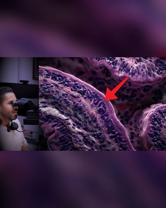 Portada del video: Gluten y enfermedad celíaca: seguía agotado y su intestino se estaba quemando