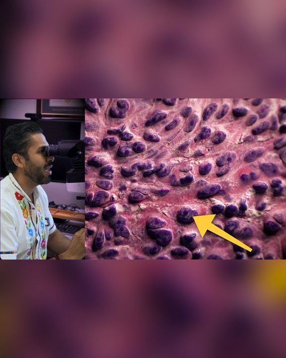 Portada del video: Pensó que su lunar cambiaba porque se lo rascaba... y era un melanoma | NEVO VS MELANOMA