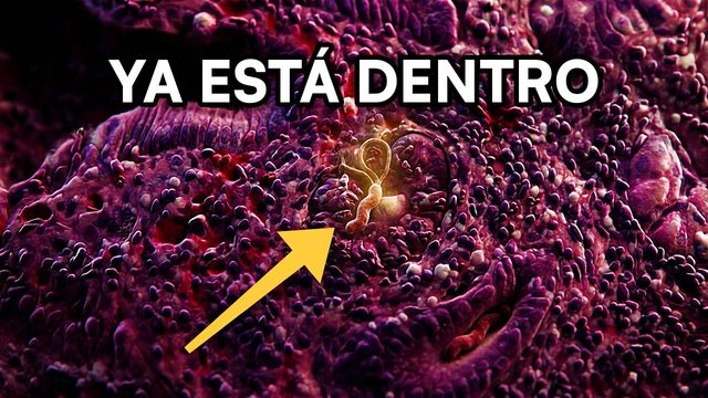 Portada del video: H. pylori: la bacteria que vive en tu estómago ahora mismo (y puede dar cáncer)