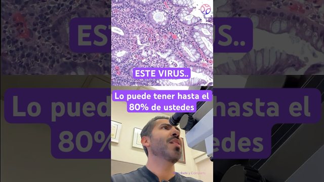 Miniatura del video: El virus que el 80% de ustedes tiene dormido ahora mismo 🔬