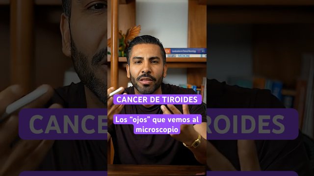 Miniatura del video: Se palpó una bolita en el cuello.. lo que vi al microscopio lo confirma todo
