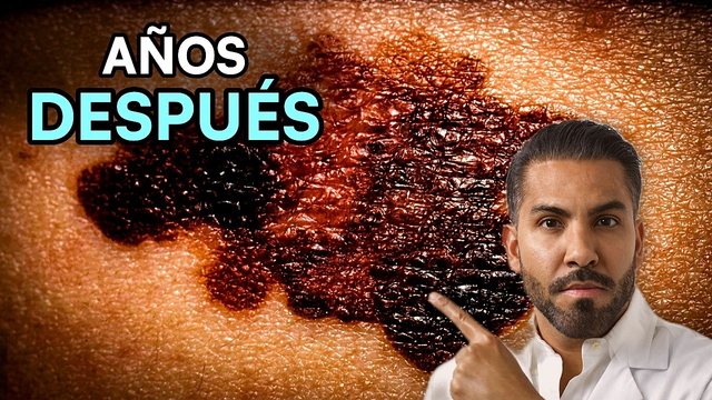 Miniatura del video: Daño solar: así el sol envejece tu piel sin que lo sientas