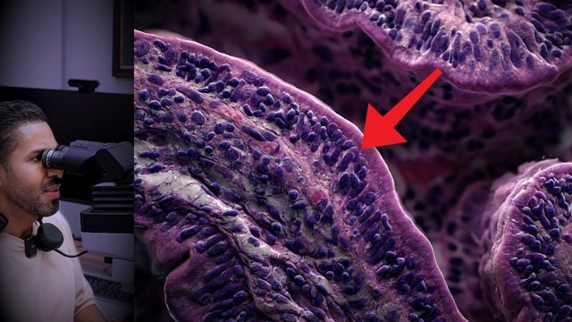 Portada del video: Gluten y enfermedad celíaca: seguía agotado y su intestino se estaba quemando