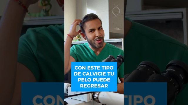 Miniatura del video: ¿Alopecia areata? En este video te explico de forma simple #alopecia #saludcapilar