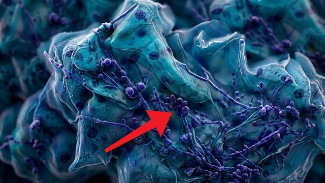 Portada del video: El Papanicolaou no solo busca cáncer... ahí salen herpes, candida y tricomonas | CITOLOGÍA CERVICAL