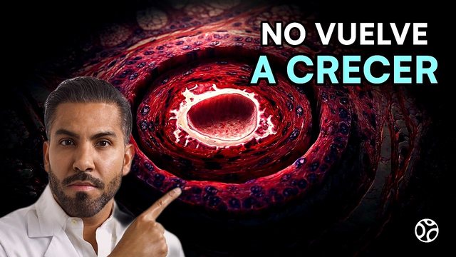 Miniatura del video: Alopecia: por qué se te cae el cabello y qué tipos sí tienen tratamiento