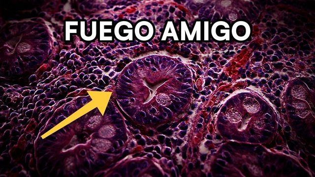 Portada del video: Gluten: tu propio cuerpo ataca tu intestino (enfermedad celíaca explicada al microscopio)