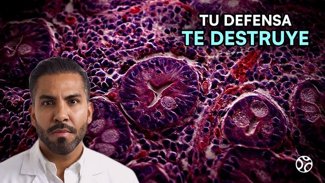 Miniatura del video: Gluten: la verdad sobre la enfermedad celíaca que casi nadie te explica