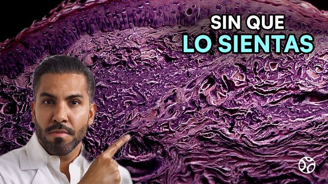 Miniatura del video: Años de sol sin sentir nada... su piel ya se estaba volviendo cáncer | QUERATOSIS ACTÍNICA