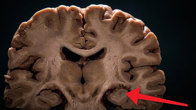 Portada del video: Lo que el alcohol le hace de verdad a tu cuerpo, trago a trago
