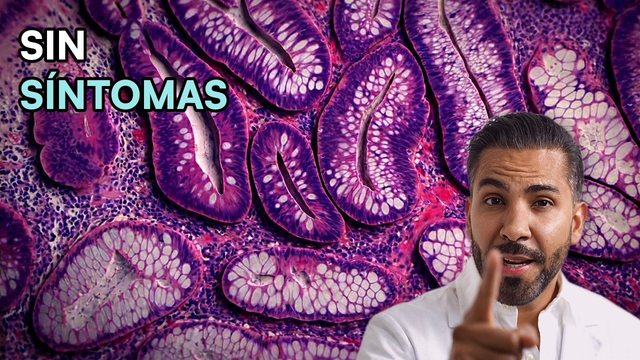 Miniatura del video: Pólipo en el colon: ¿inofensivo o el primer paso al cáncer?