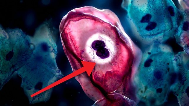 Portada del video: Preguntas por qué te dio el papiloma humano... casi todos lo van a tener | VPH