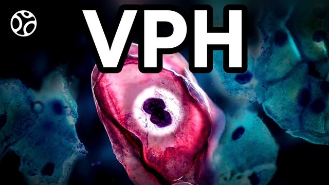 Miniatura del video: Preguntas por qué te dio el papiloma humano... casi todos lo van a tener | VPH